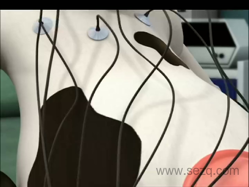 疯狂农场 - 动画资源画廊第2张